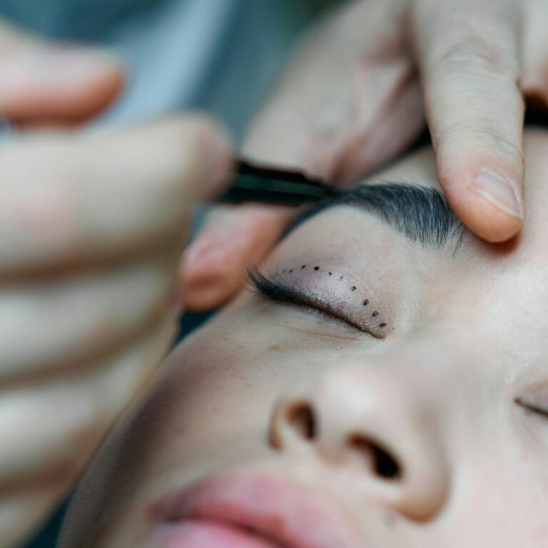 Eyes Procedures